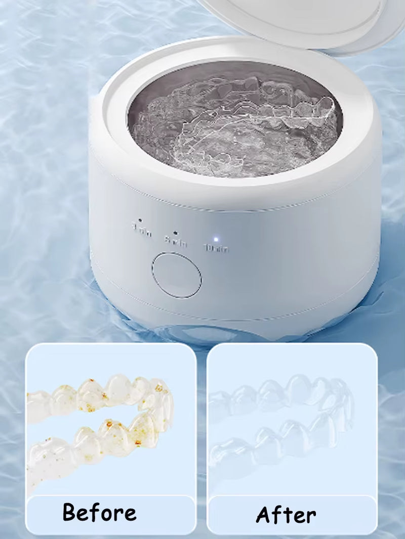 Portable Ultrasonic Retainer Cleaner Machine for Dentures Retainer Mouth Guard Aligner Whitening Trays Personal Oral Supplies