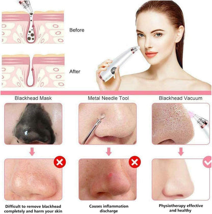 Pore Cleaner Blackhead Remover Vacuum Acne Comedone Extractor Facial Pore Cleanser Sucker Spot Pimple Whitehead Deep Suction